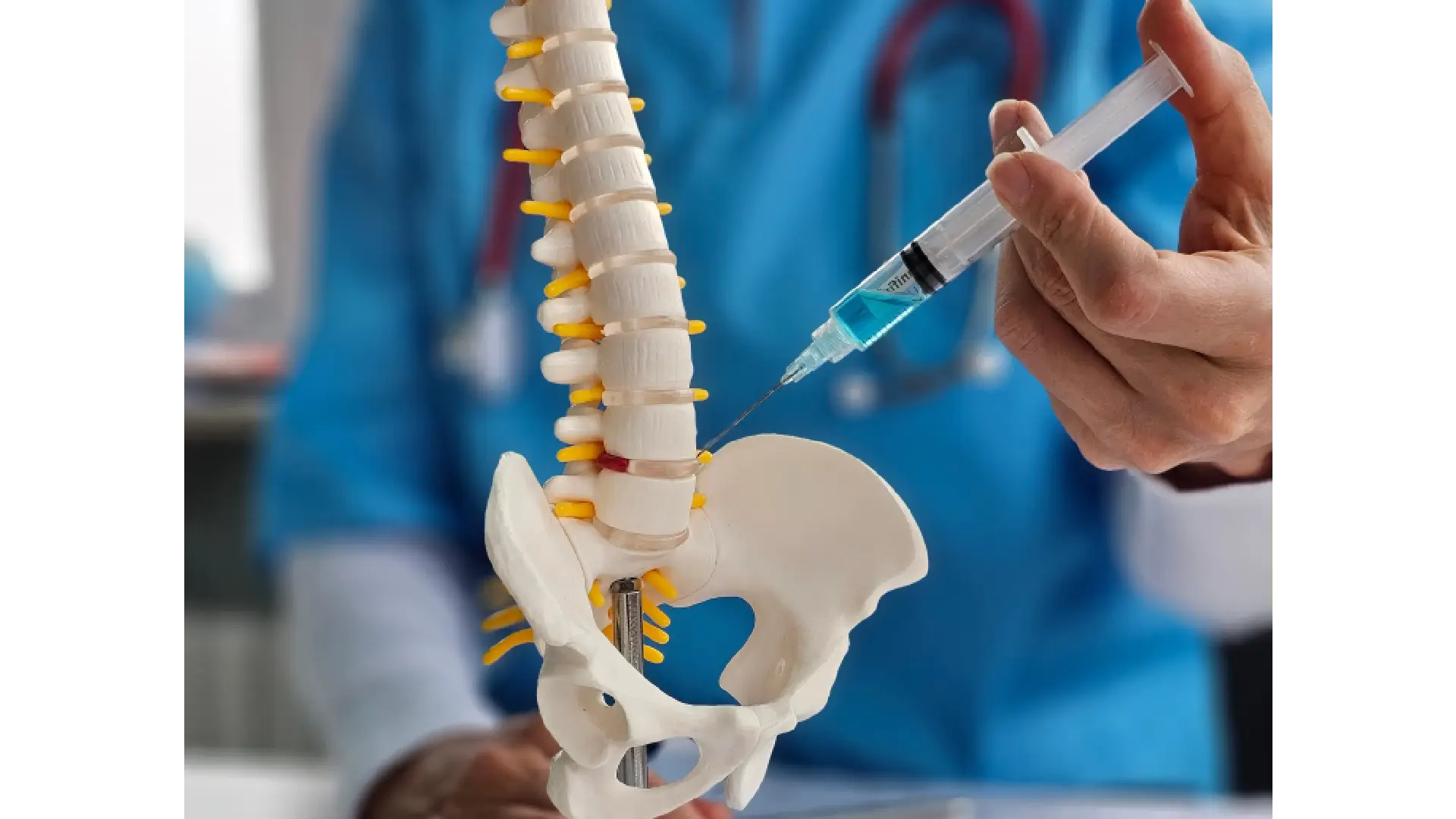 Lumbar Medial Branch Block