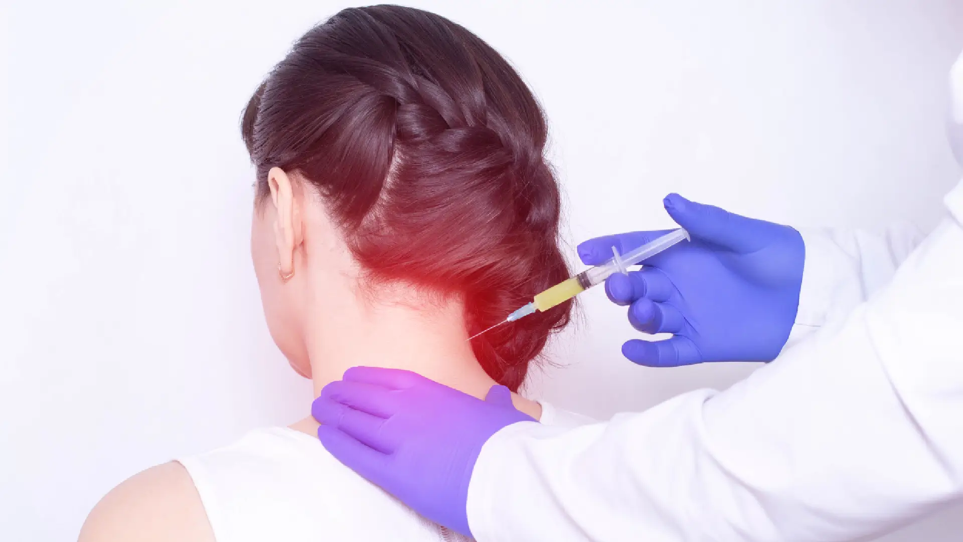 Occipital Nerve Block